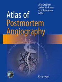 Atlas of Postmortem Angiography -  - E-Book