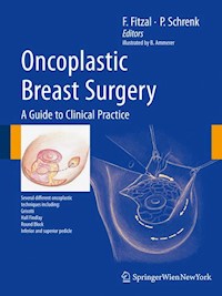 Oncoplastic Breast Surgery -  - E-Book