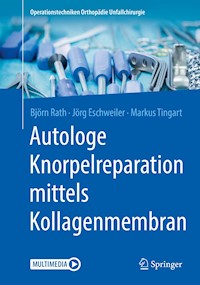 Autologe Knorpelreparation mittels Kollagenmembran - Björn Rath - E-Book