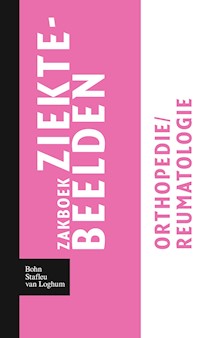 Zakboek ziektebeelden Orthopedie / Reumatologie - Karin Linden - E-Book