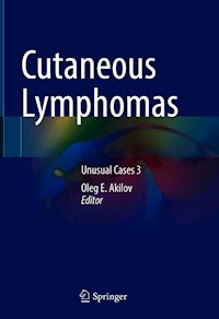 Cutaneous Lymphomas -  - E-Book