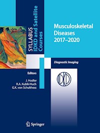 Musculoskeletal Diseases 2017-2020 -  - E-Book