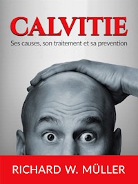 Calvitie (Traduit) - W. Richard Müller - E-Book