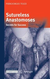 Sutureless Anastomoses - Piergiorgio Tozzi - E-Book