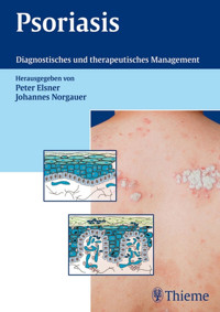 Psoriasis -  - E-Book