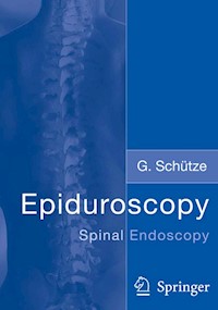 Epiduroscopy - Günter Schütze - E-Book