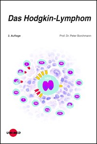 Das Hodgkin-Lymphom - Peter Borchmann - E-Book