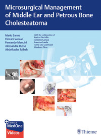 Microsurgical Management of Middle Ear and Petrous Bone Cholesteatoma - Mario Sanna - E-Book