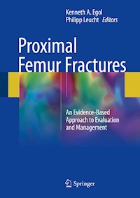 Proximal Femur Fractures -  - E-Book