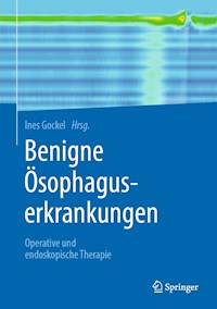 Benigne Ösophaguserkrankungen -  - E-Book