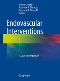 Endovascular Interventions -  - E-Book