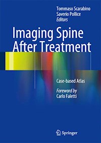 Imaging Spine After Treatment -  - E-Book