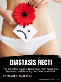 Diastasis Recti - Ethan D. Anderson - E-Book