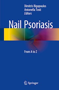 Nail Psoriasis -  - E-Book