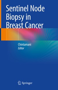 Sentinel Node Biopsy in Breast Cancer -  - E-Book