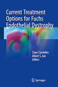 Current Treatment Options for Fuchs Endothelial Dystrophy -  - E-Book