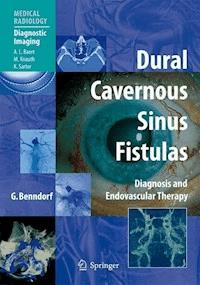 Dural Cavernous Sinus Fistulas - Goetz Benndorf - E-Book