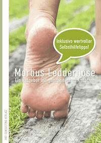Morbus Ledderhose - Stefan Abt - E-Book
