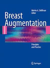 Breast Augmentation -  - E-Book