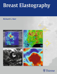 Breast Elastography - Richard G. Barr - E-Book