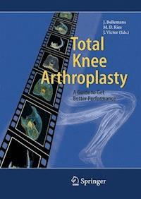 Total Knee Arthroplasty -  - E-Book