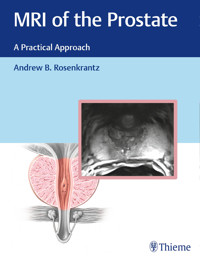 MRI of the Prostate -  - E-Book