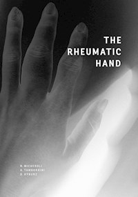 The Rheumatic Hand - Raphael Micheroli - E-Book