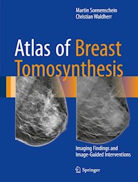 Atlas of Breast Tomosynthesis - Martin Sonnenschein - E-Book