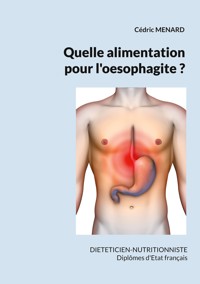 Quelle alimentation pour l'oesophagite ? - Cedric Menard - E-Book