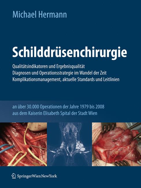 Schilddrüsenchirurgie - Qualitätsindikatoren und Ergebnisqualität, Diagnosen und Operationsstrategie im Wandel der Zeit, Komplikationsmanagement, aktuelle Standards und Leitlinien - Michael Hermann - E-Book