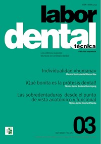 Labor Dental Técnica Nº3 Vol.25 -  - E-Book