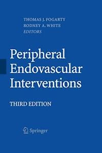 Peripheral Endovascular Interventions -  - E-Book