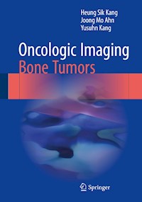 Oncologic Imaging: Bone Tumors - Heung Sik Kang - E-Book