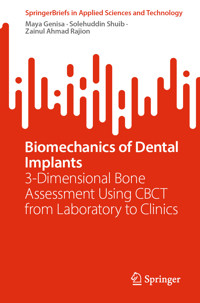 Biomechanics of Dental Implants - Maya Genisa - E-Book