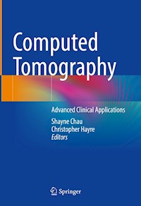 Computed Tomography -  - E-Book