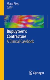 Dupuytren’s Contracture -  - E-Book
