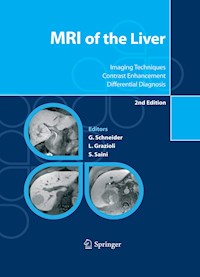 MRI of the Liver -  - E-Book