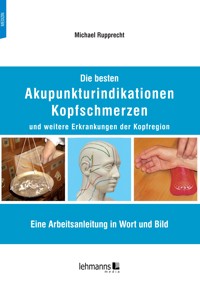 Die besten Akupunkturindikationen Kopfschmerzen und weitere Erkrankungen der Kopfregion - Michael Rupprecht - E-Book