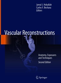 Vascular Reconstructions -  - E-Book