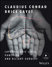 Laparoscopic Liver, Pancreas, and Biliary Surgery - - E-Book