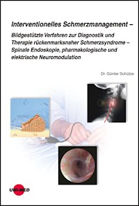 Interventionelles Schmerzmanagement - Günter Schütze - E-Book