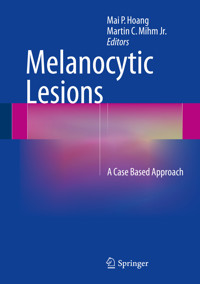 Melanocytic Lesions -  - E-Book