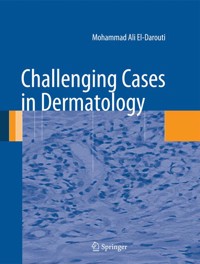 Challenging Cases in Dermatology - Mohammad Ali El-Darouti - E-Book