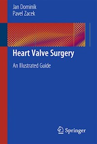 Heart Valve Surgery - Jan Dominik - E-Book