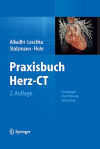 Praxisbuch Herz-CT -  - E-Book
