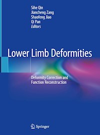 Lower Limb Deformities -  - E-Book