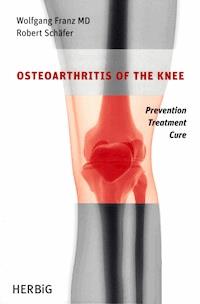 Osteoarthritis of the knee - Wolfgang Franz - E-Book