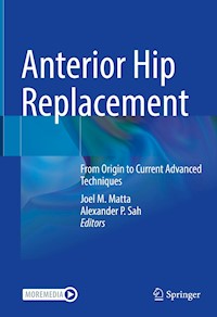 Anterior Hip Replacement -  - E-Book