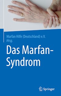 Das Marfan-Syndrom - - E-Book
