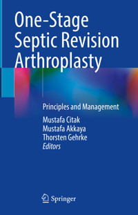 One-Stage Septic Revision Arthroplasty -  - E-Book